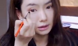 戚薇爆料割双眼皮视频,揭秘明星整形真相